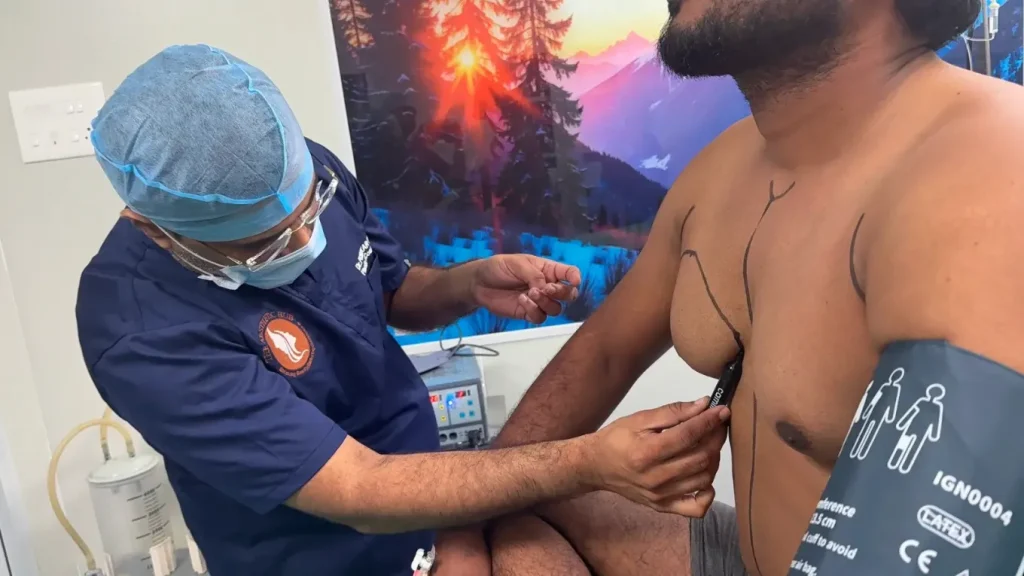 Best Gynecomastia Surgeon In Baner
